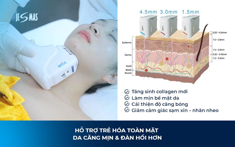 HIFU Làm Tăng Sinh Collagen Như Thế Nào?